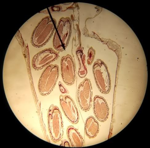 Mature Embryo 111