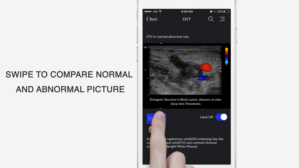  photo Swipe function.png